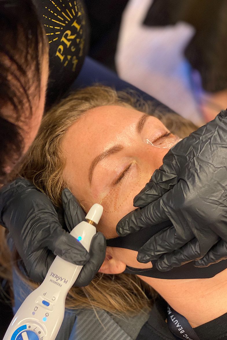A professional device held to a client's brow during a Fibroblast treatment
